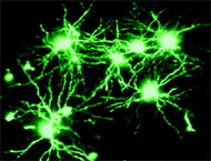 http://www.docelimao.com.br/images/neuronios.jpg