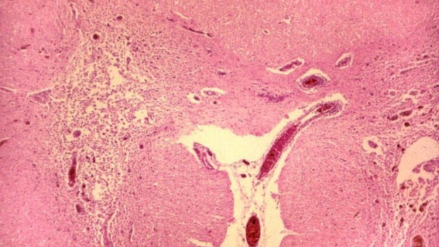 A experiência do Dr. Sandler